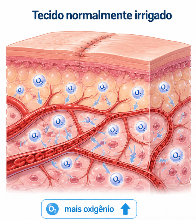 Esquema de tecido normalmente irrigado, com vasos sanguíneos bem distribuídos e maior oferta de oxigênio chegando às células.